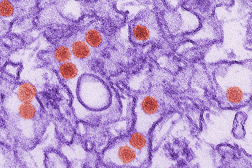 Zika virus